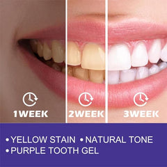 Purple Whitening Toothpaste™ (2Pieces) ! ™معجون الأسنان الأرجواني