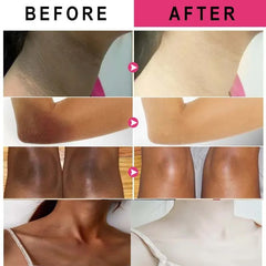 Whitening Skin Stick for Private Parts